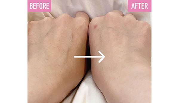 ミス ディオール ボディ スクラブ使用 BEFORE→AFTER