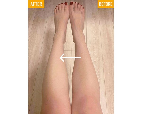 ボディライン ノンセルラ ジェル使用 BEFORE→AFTER