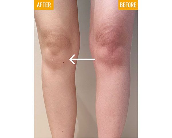 ロルロゼ ピンクフィット ボディオイル 2.0使用 BEFORE→AFTER