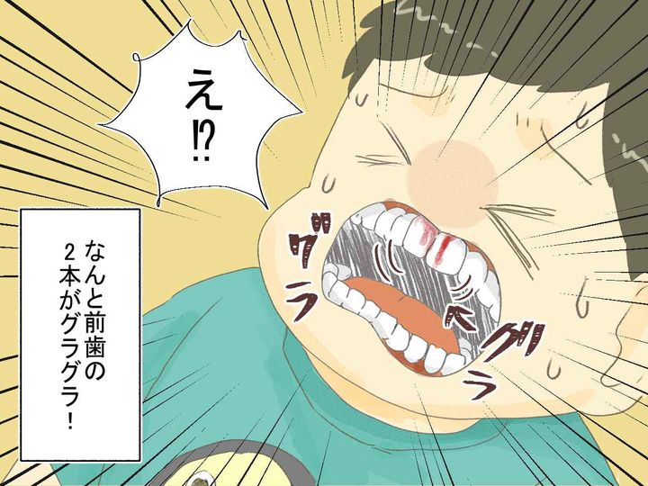 画像3: 「ママお口痛いよ～」唇を切っただけと思っていた息子、実は……