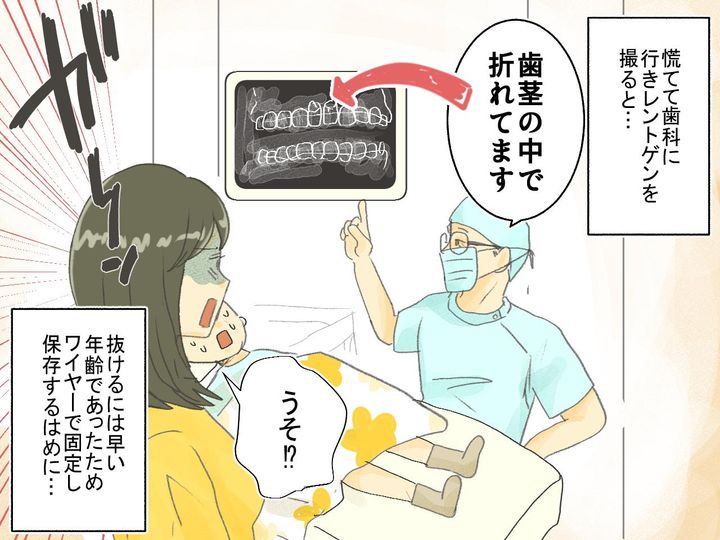 画像4: 「ママお口痛いよ～」唇を切っただけと思っていた息子、実は……