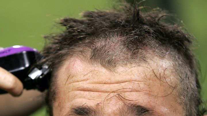 癌で髪を失った24歳選手のために…同僚全員が髪を剃った姿に涙！タトゥーを彫る選手も