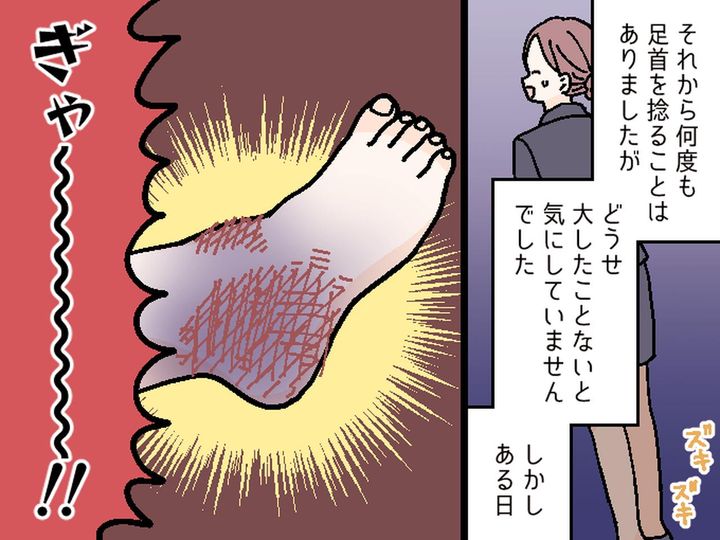 画像3: 捻挫を繰り返した結果？