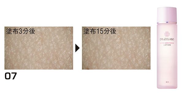 07：ドクターシーラボ／塗布3分後、塗布15分後