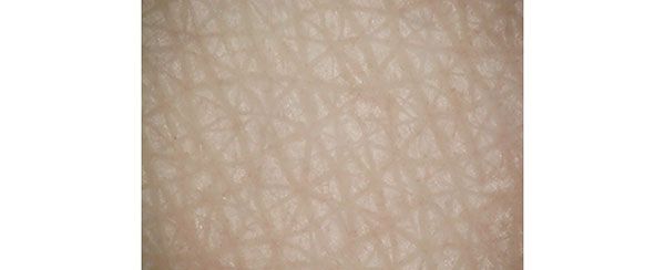 前腕の内側に化粧水を塗布したとき、皮膚の表面がどう変化するかをマイクロスコープで拡大して観察 BEFORE