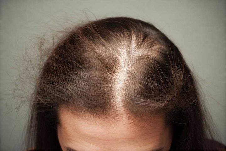 分け目が気になる、前髪がスカスカに