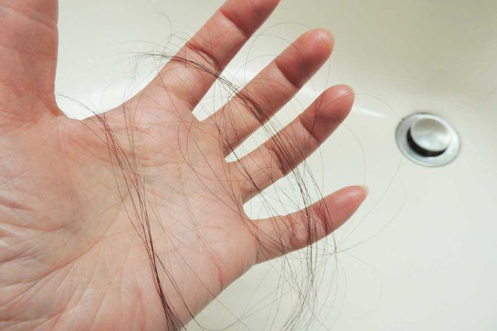 ごっそり……抜け毛にショック＆恐怖