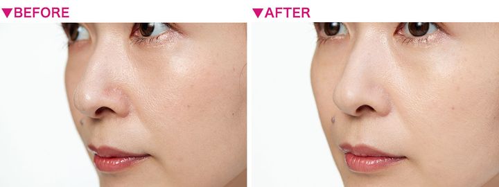 【小鼻の赤みが目立つ】メイク直しの方法と赤み対策をプロが徹底解説！