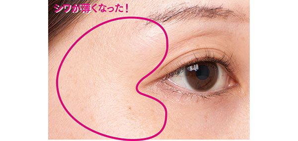 After シワが薄くなった！ 千晴さん