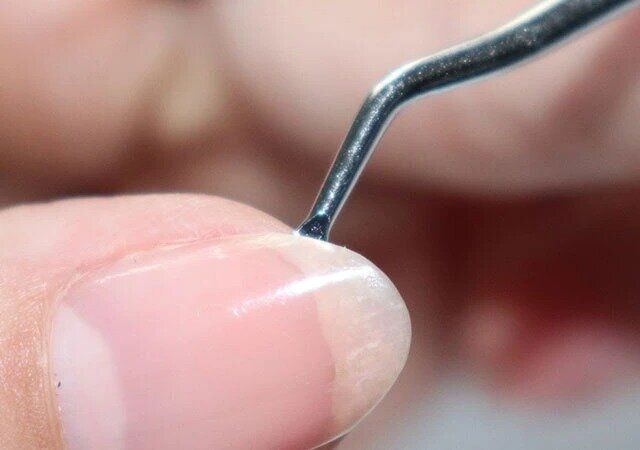 ダイソー ステンレスネイルクリーナー