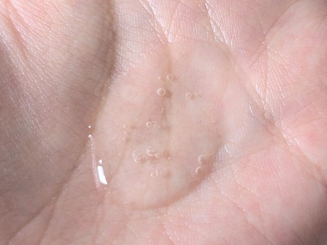 オルビスの写真