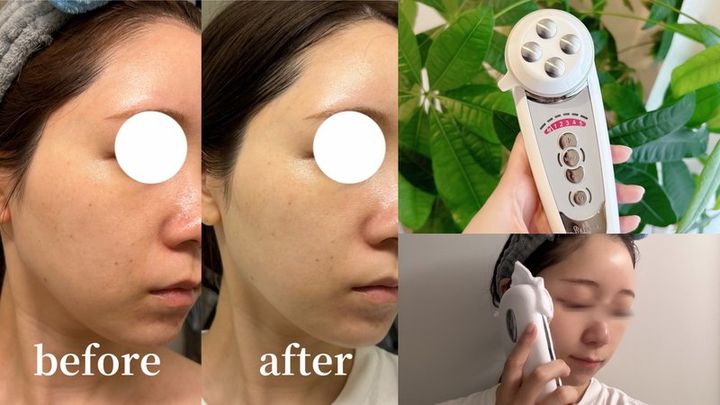 MEGUMIさん愛用で話題！セルキュアの美顔器って本当に効果あるの