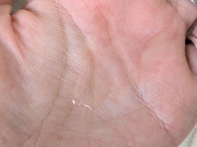 エトヴォスの写真