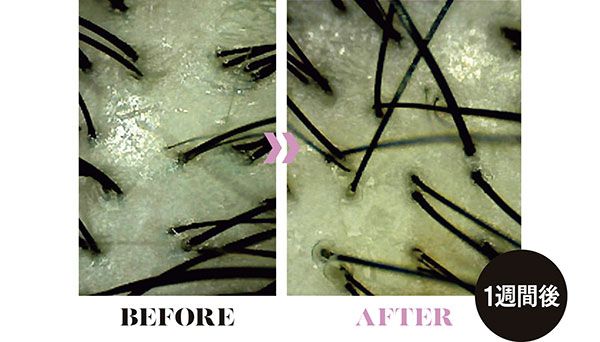 UVスプレーなし BEFORE AFTER 1週間後