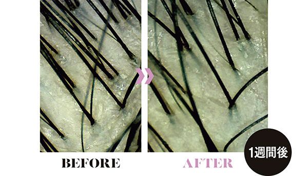 UVスプレーあり BEFORE AFTER 1週間後