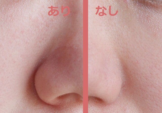 ダイソー UGTポアレスベース01c 比較 頬