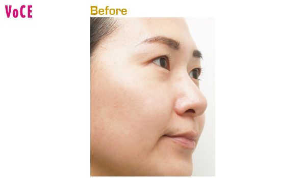 Before／見た目の印象