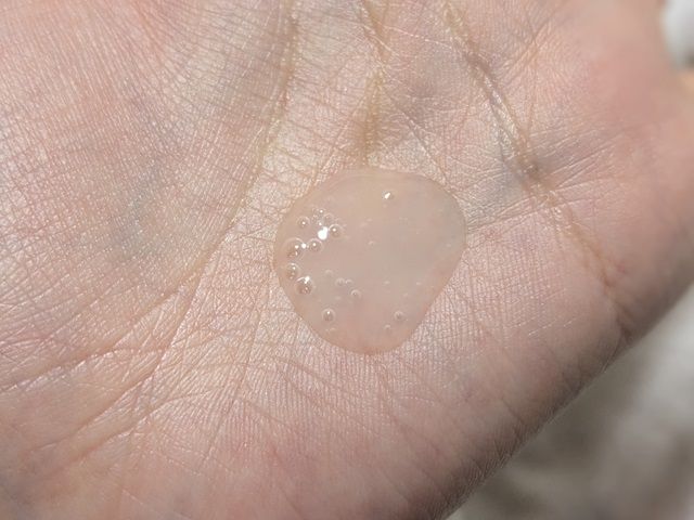 カルテHDの写真