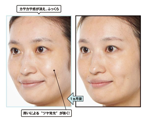 1ヵ月後→カサカサ感が消え、ふっくら。潤いによる“ツヤ発光”が強く！