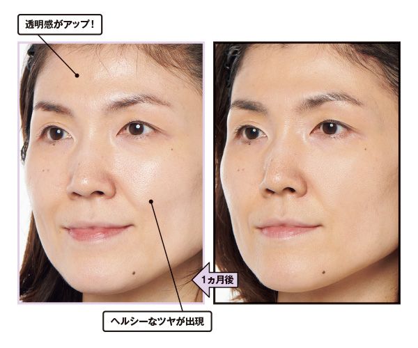 1ヵ月後→透明感がアップ！ ヘルシーなツヤが出現。