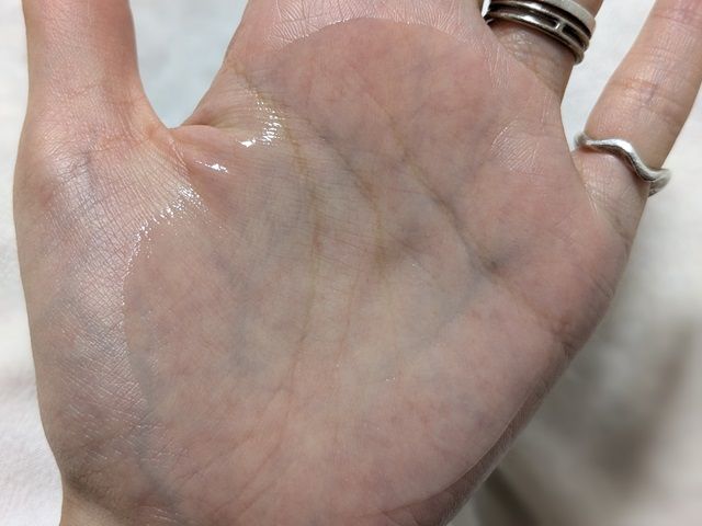 カルテHDの写真