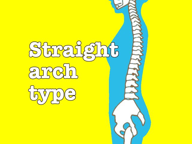 ストレートアーチタイプの画像