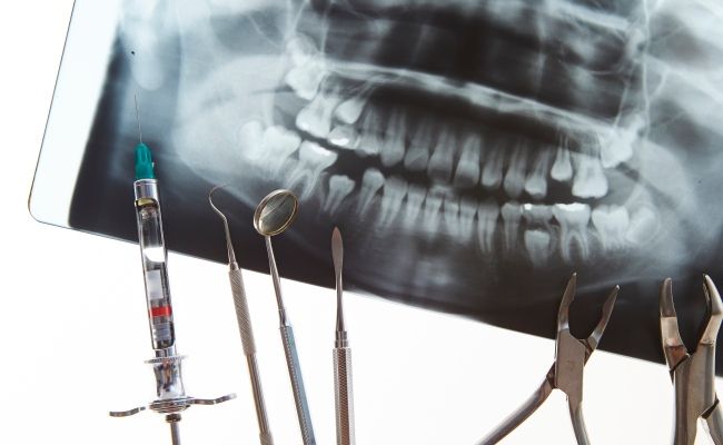 レントゲン写真と手術器具のイメージ