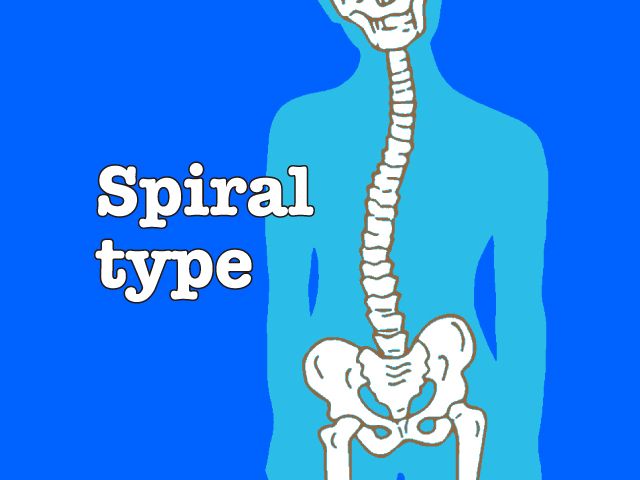 スパイラルタイプ