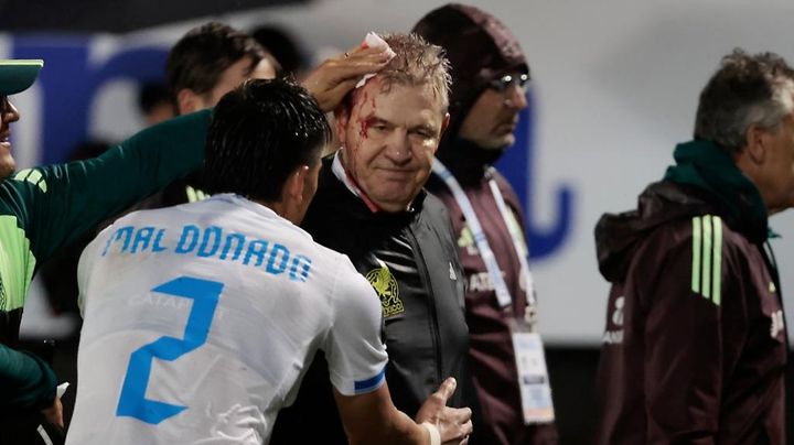 日本代表元監督を大流血させた犯人、「殺人未遂」だと警察長官が発言