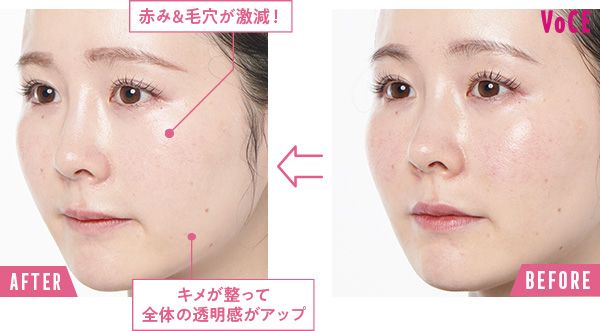 BEFORE→AFTER 赤み＆毛穴が激減！ キメが整って全体の透明感がアップ