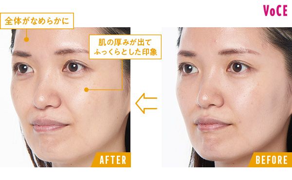BEFORE→AFTER 全体がなめらかに 肌の厚みが出てふっくらとした印象