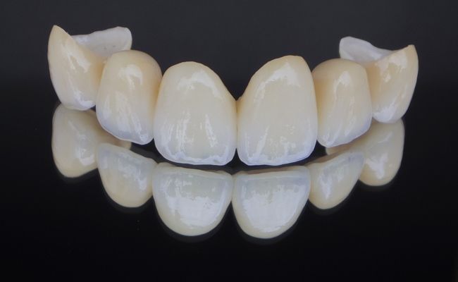 ジルコニアのイメージ