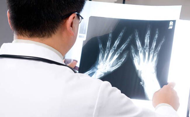 レントゲンを確認する医師