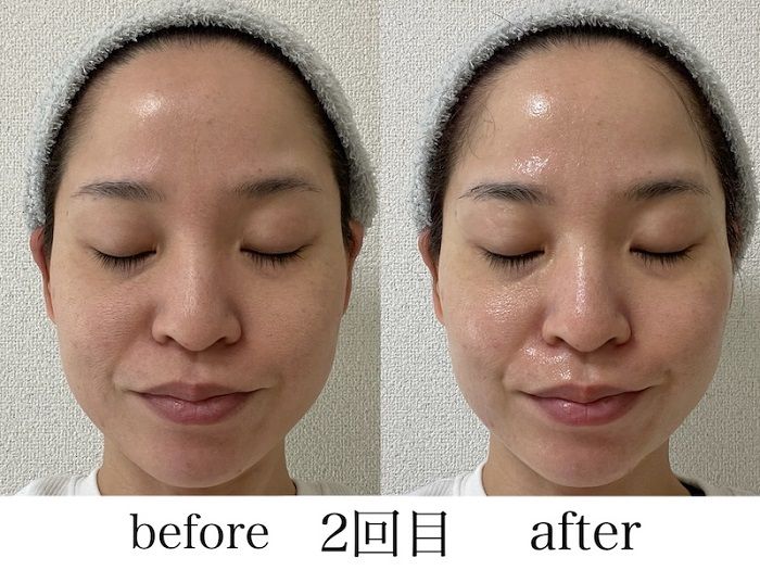 シートマスクを顔に装着する２回目