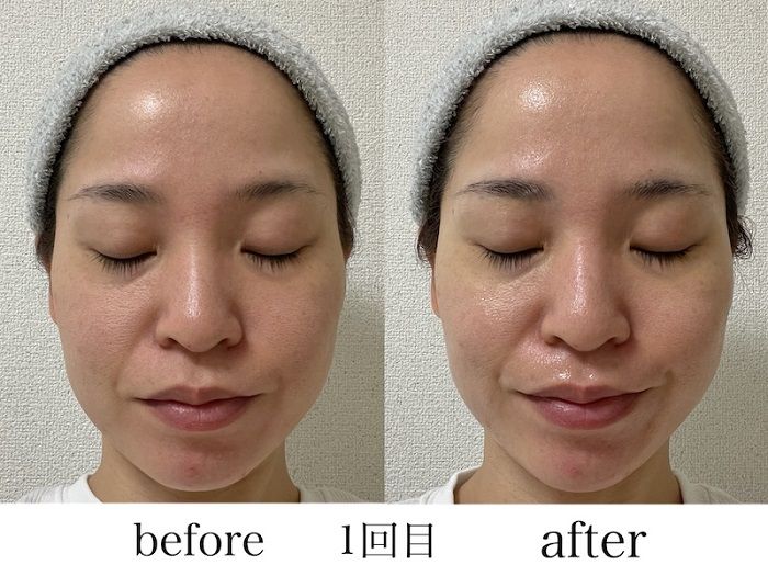 シートマスクを顔に装着する１回目