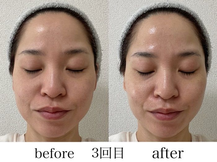 シートマスクを顔に装着する３回目