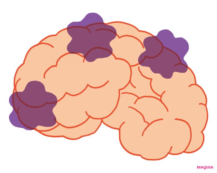 ネット漬けのあなたは必読！脳疲労が起きた時、脳内ではこんなことが起こっている