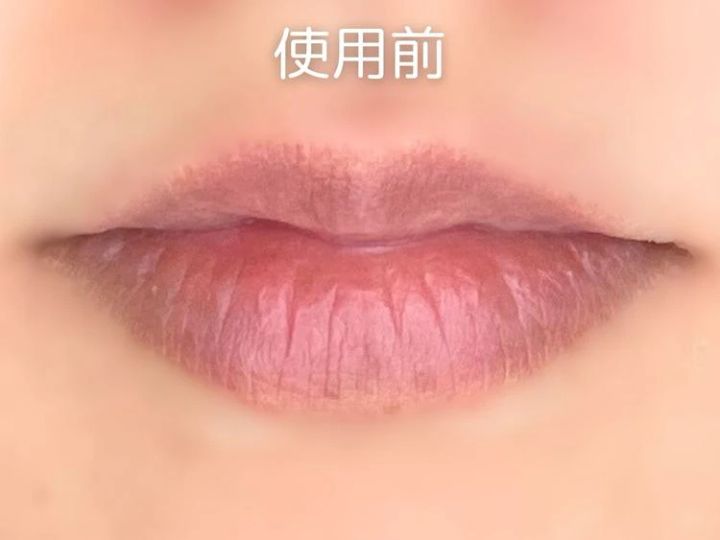 【トリデン リップ美容液 口コミ】ソリッドイン リップエッセンス