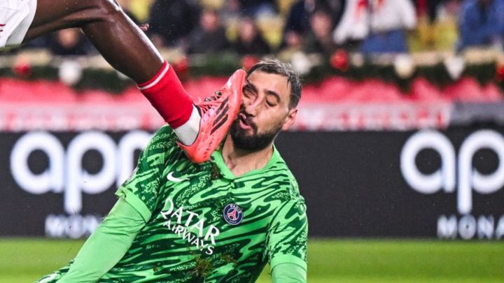 顔面へのキックでサッカー選手が大怪我…ショッキングな負傷状態に心配の声