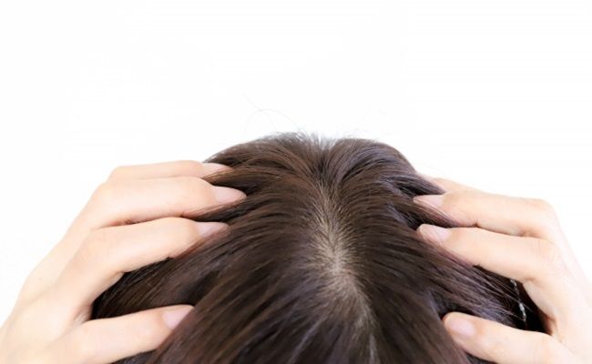 頭皮を触る女性