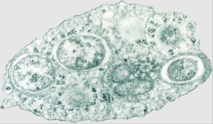 ボルバキアの電子顕微鏡画像