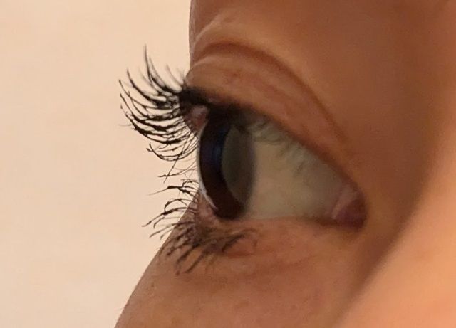 リンメルの写真