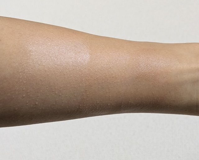 リンメルの写真