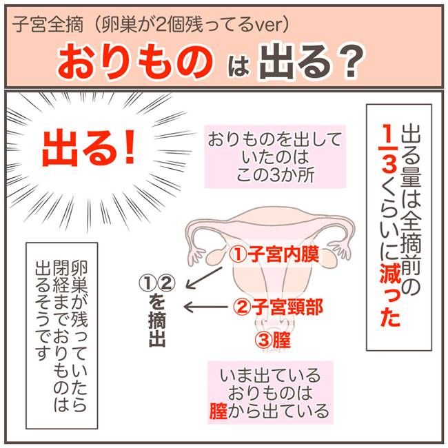 子宮を全摘したらどんな感じ？