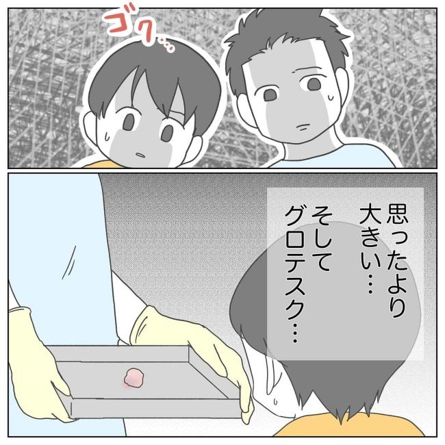 おかあさんの乳がん1