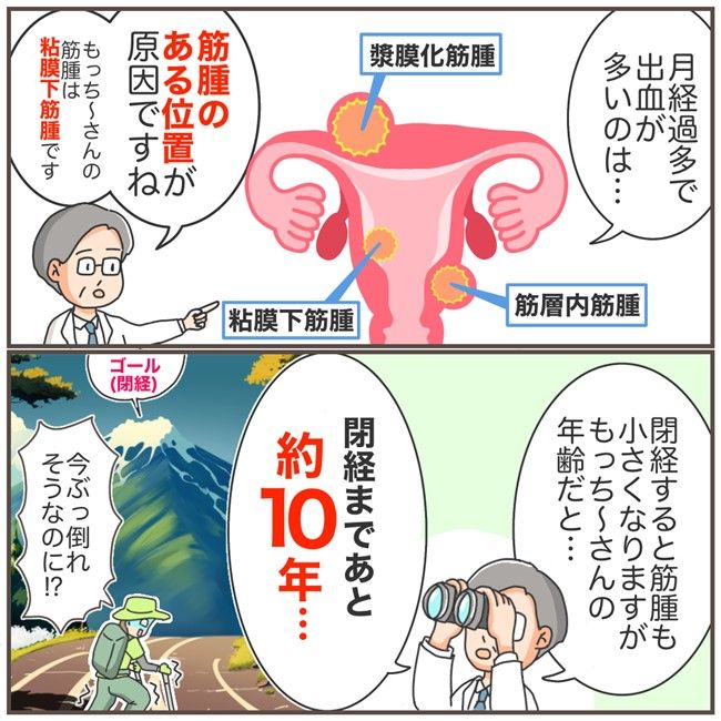 私が子宮全摘出を決めた理由