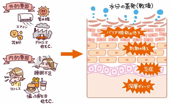 肌の断面図 敏感肌