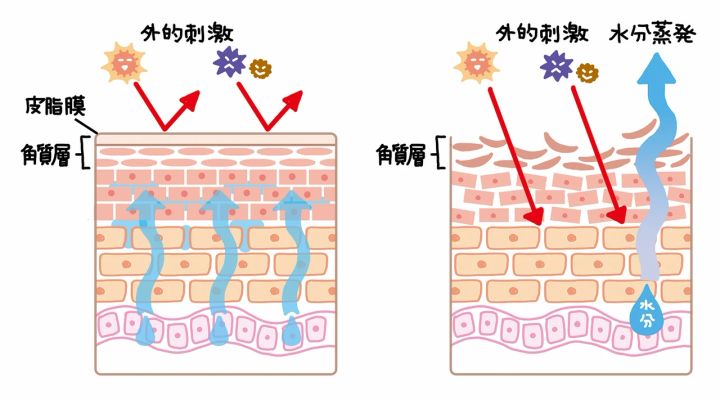 肌の断面図 敏感肌