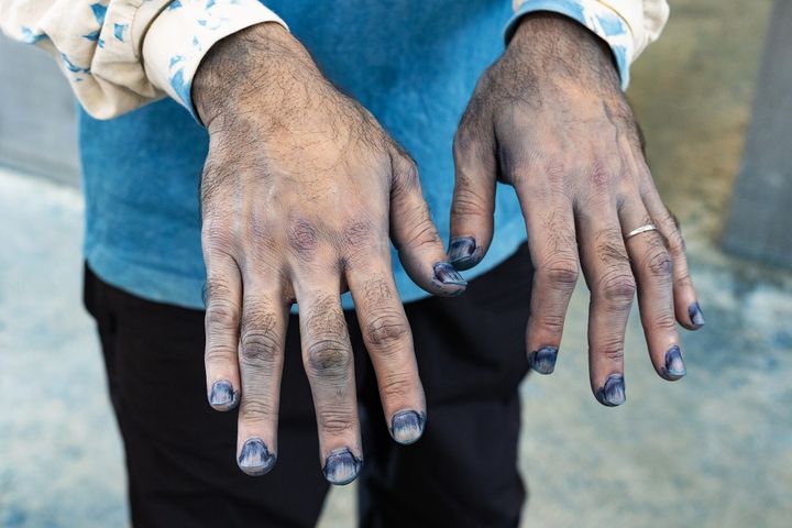 真っ青に染まった東恩納さんの手