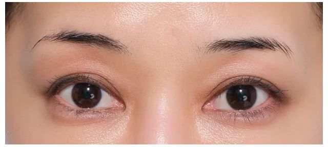 細眉タイプによくあるお悩み解消法